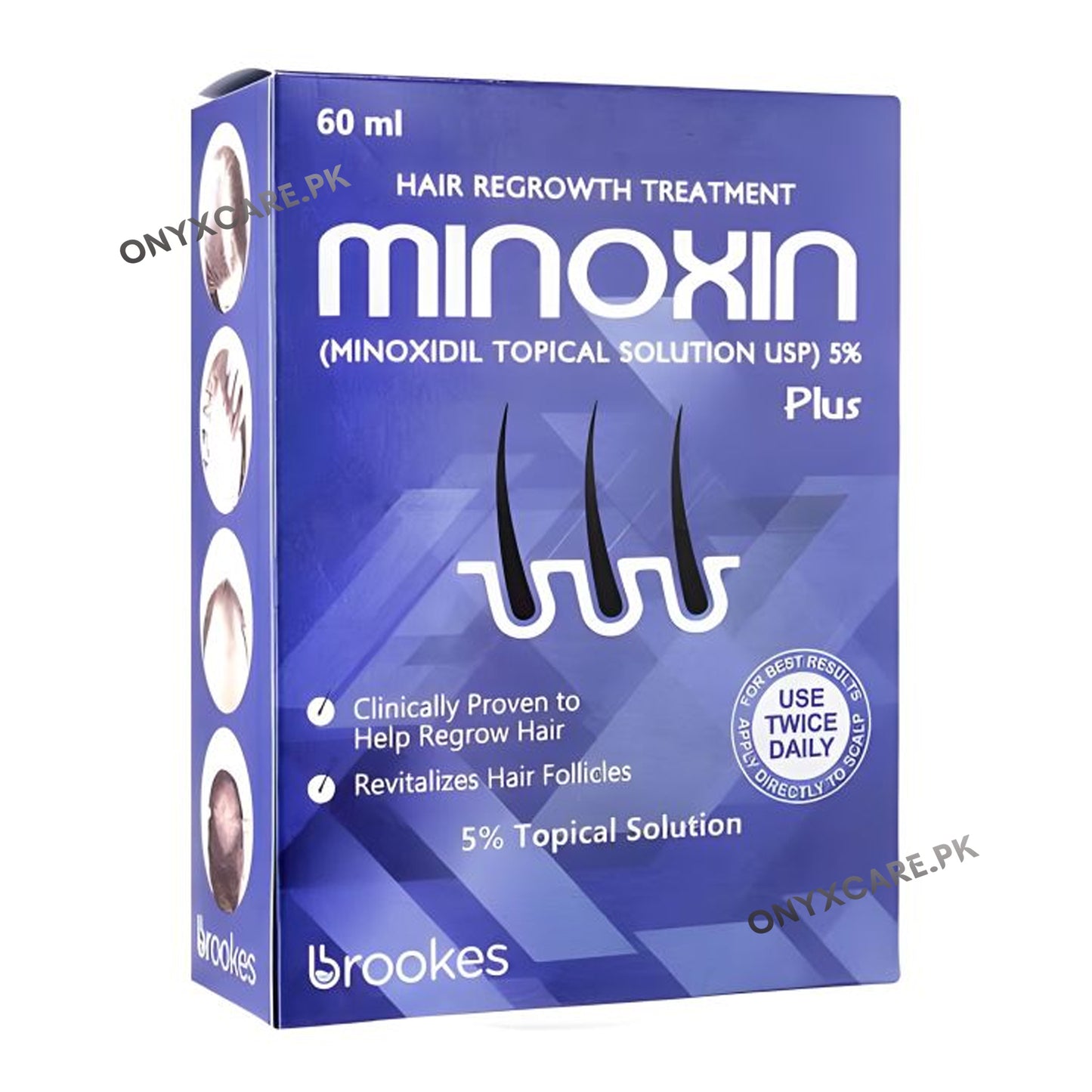 Minoxin Plus Topical Solution 60ml