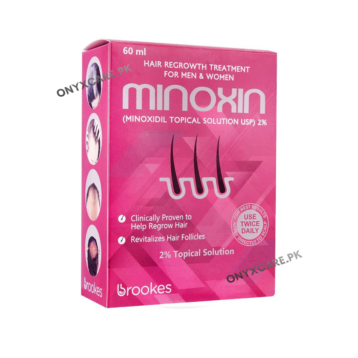 Minoxin Solution 2% 60ml