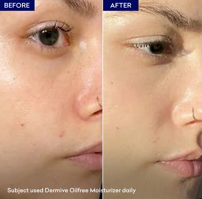 Dermive Oil Free Moisturizing Lotion 100ml