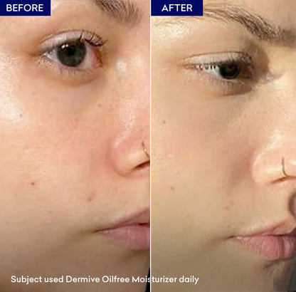 Dermive Oil Free Moisturizing Lotion 100ml